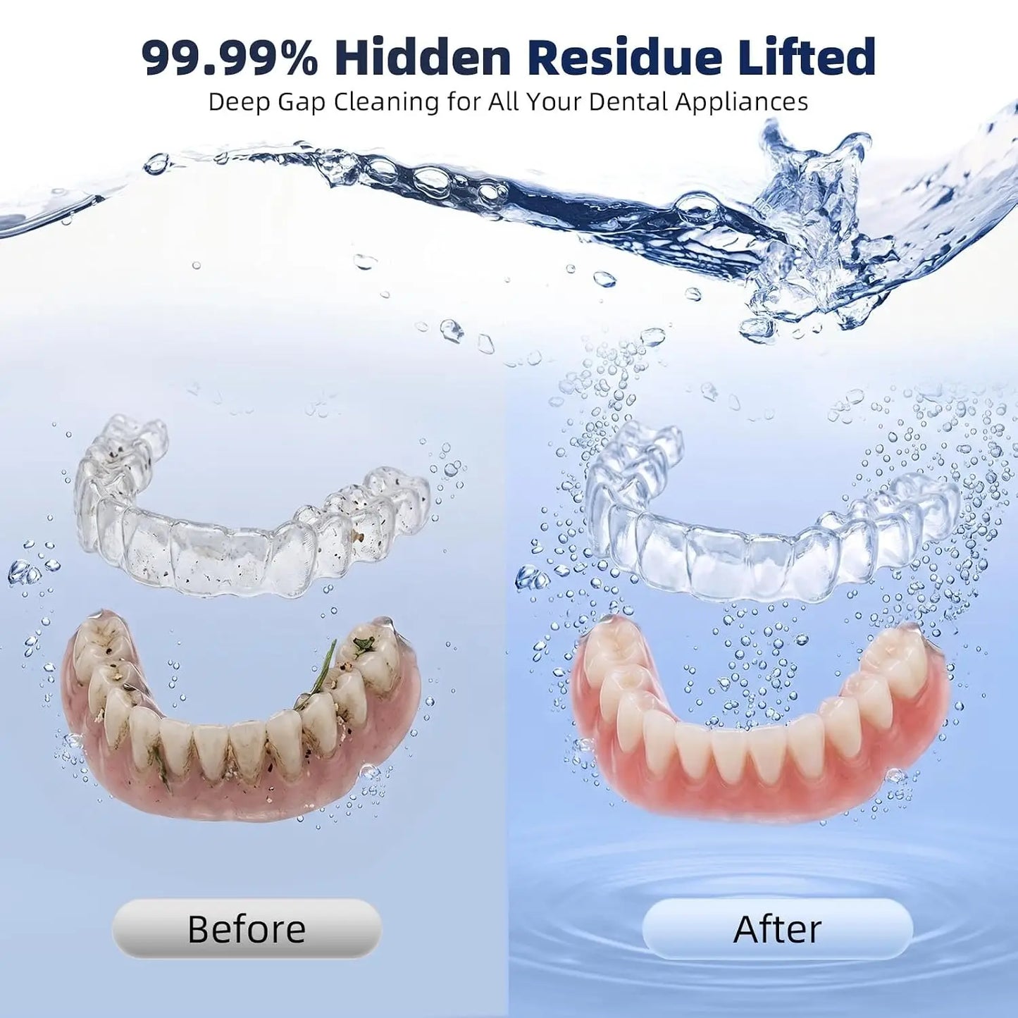 Ultrasonic Retainer Cleaner: 45kHz 200ML Dual Modes for Aligners, Jewelry